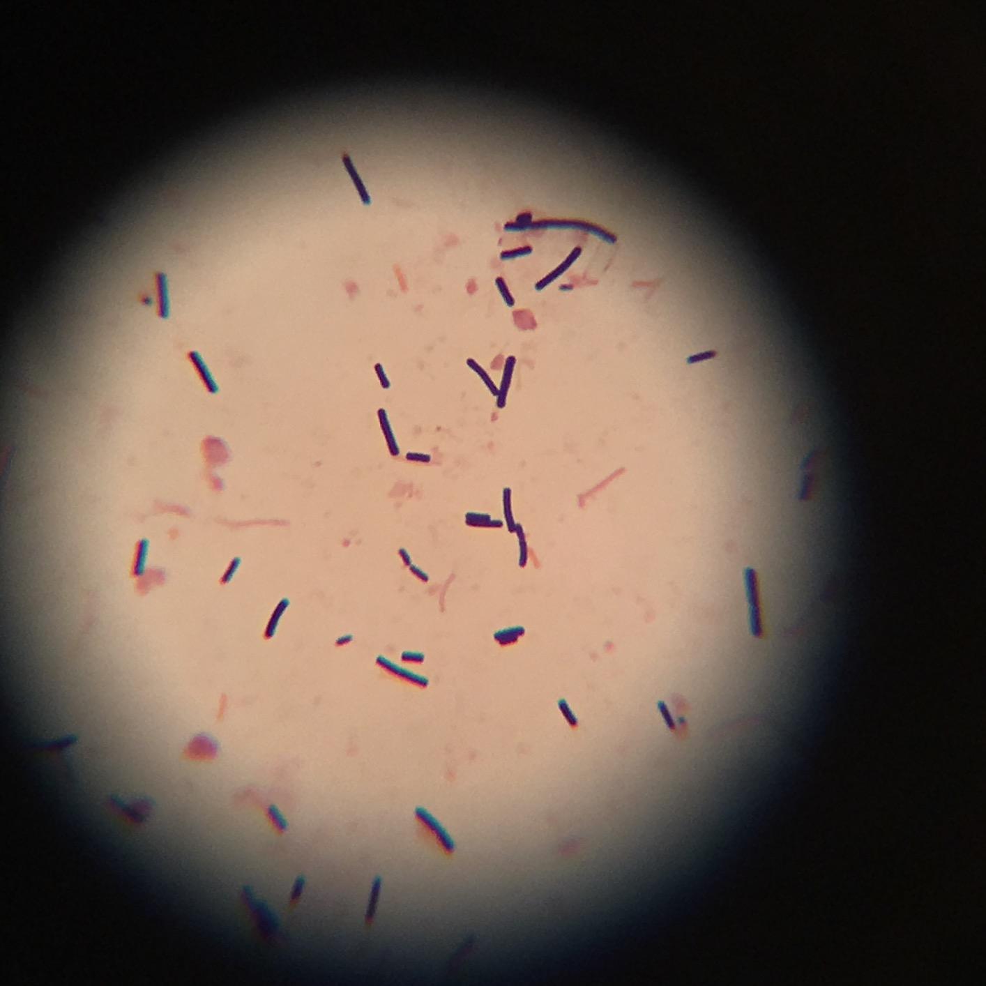 AmScope T490B Compound Trinocular Microscope, 2000X Magnification customer photo 2