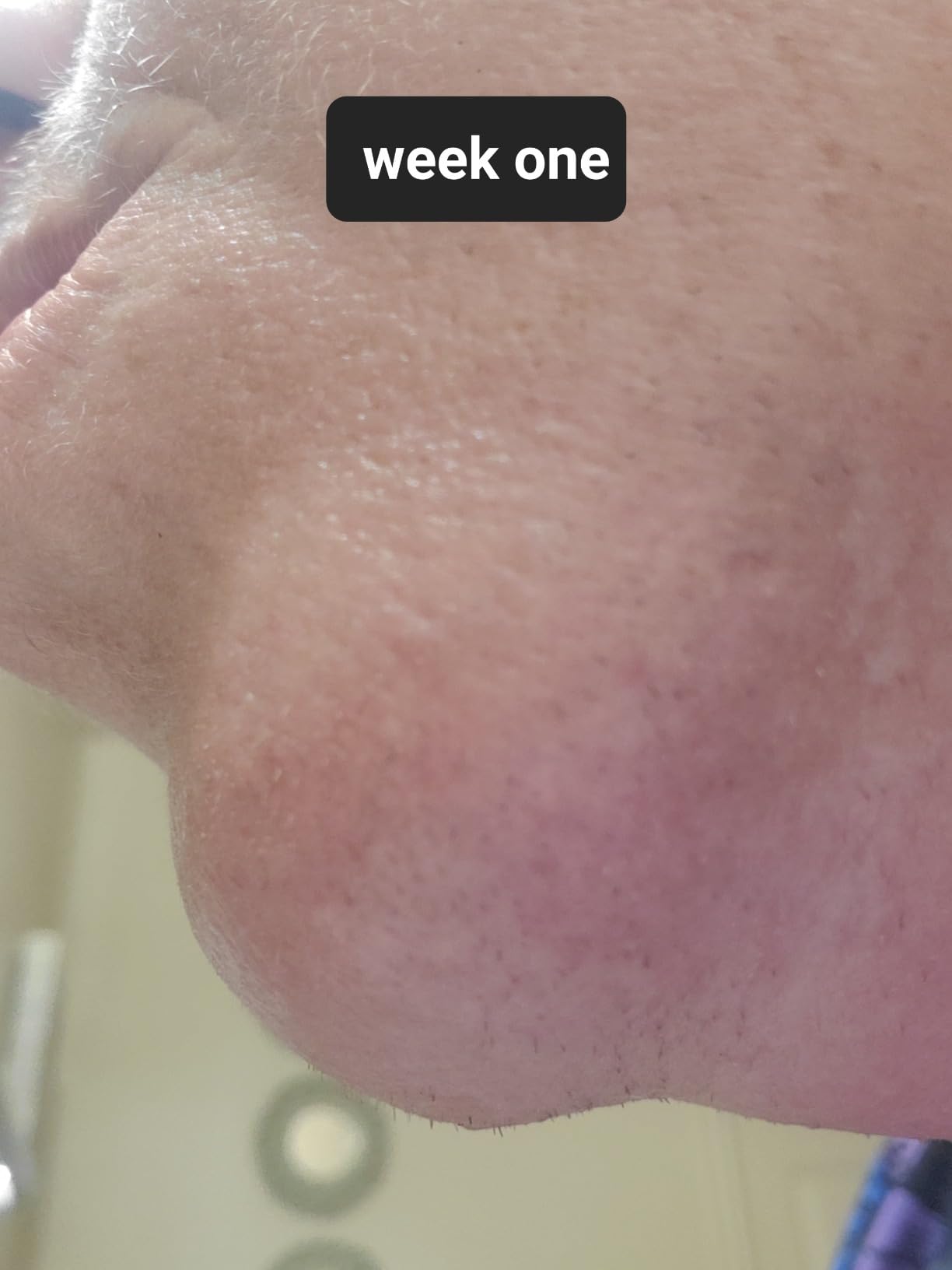 SmoothSkin Pure Fit IPL Hair Removal Device - At-Home Laser Hair Removal for Women & Men, Visible Results in 2 Weeks, Includes Precision Head, Safe for Face & Body, Long-Lasting Hair Reduction customer photo 2