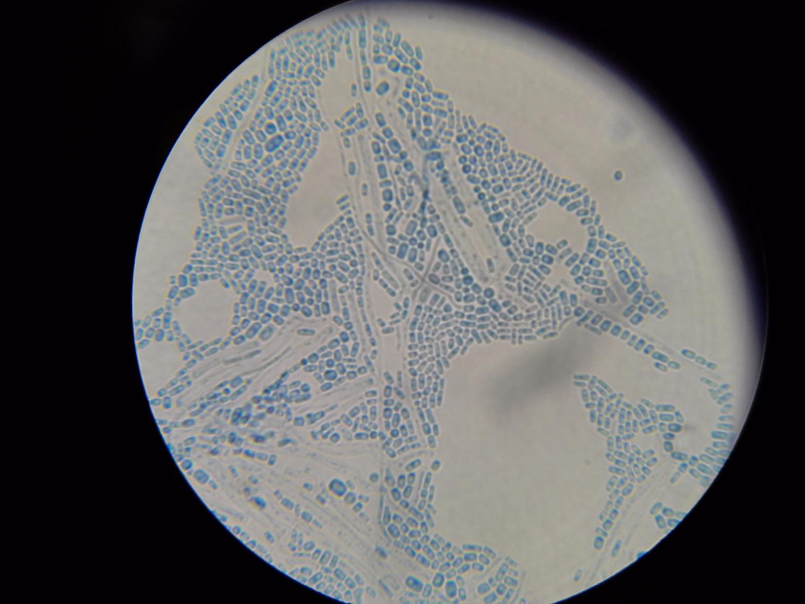 OMAX M82ES-SC100-LP100-OM 2000X LED Binocular Compound Lab Microscope customer photo 2