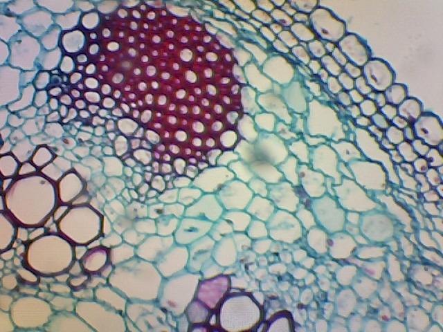AmScope B120C-E1 LED Binocular Compound Microscope, 40X-2500X customer photo 1