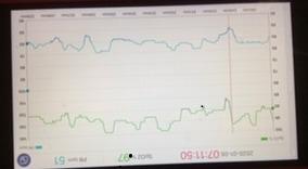 EMAY Sleep Oxygen Monitor with Built-in Recording Capability | Track Continuous Blood Oxygen Levels & Pulse Rate Overnight | Provides Sleep Report & Raw Data customer photo 2