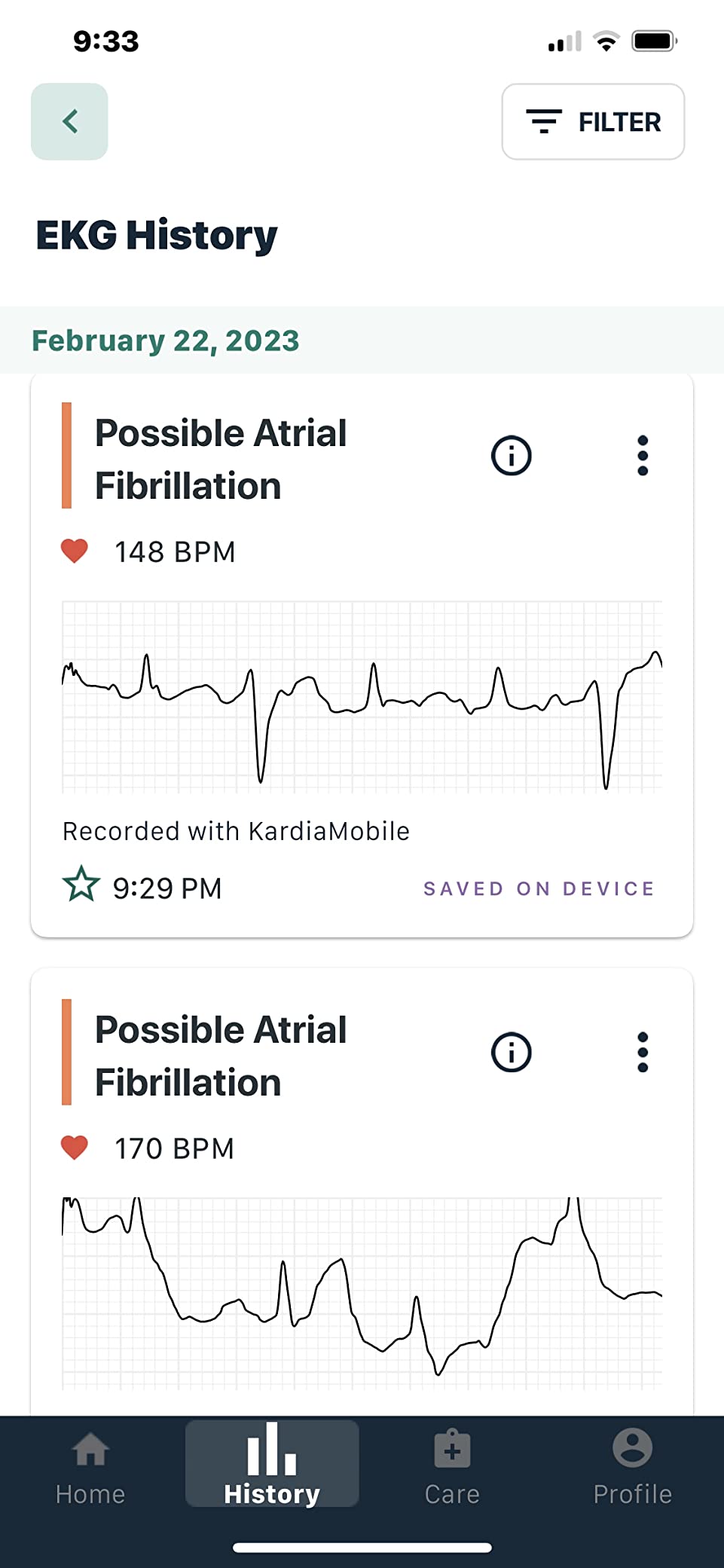 KardiaMobile Card Credit-Card Sized EKG, Medical-Grade & FDA-Cleared Personal Heart Monitor, Bluetooth Enabled, On-The-Go Check-Up Anywhere, Compatible with Most Smartphones, No Subscription Required customer photo 2