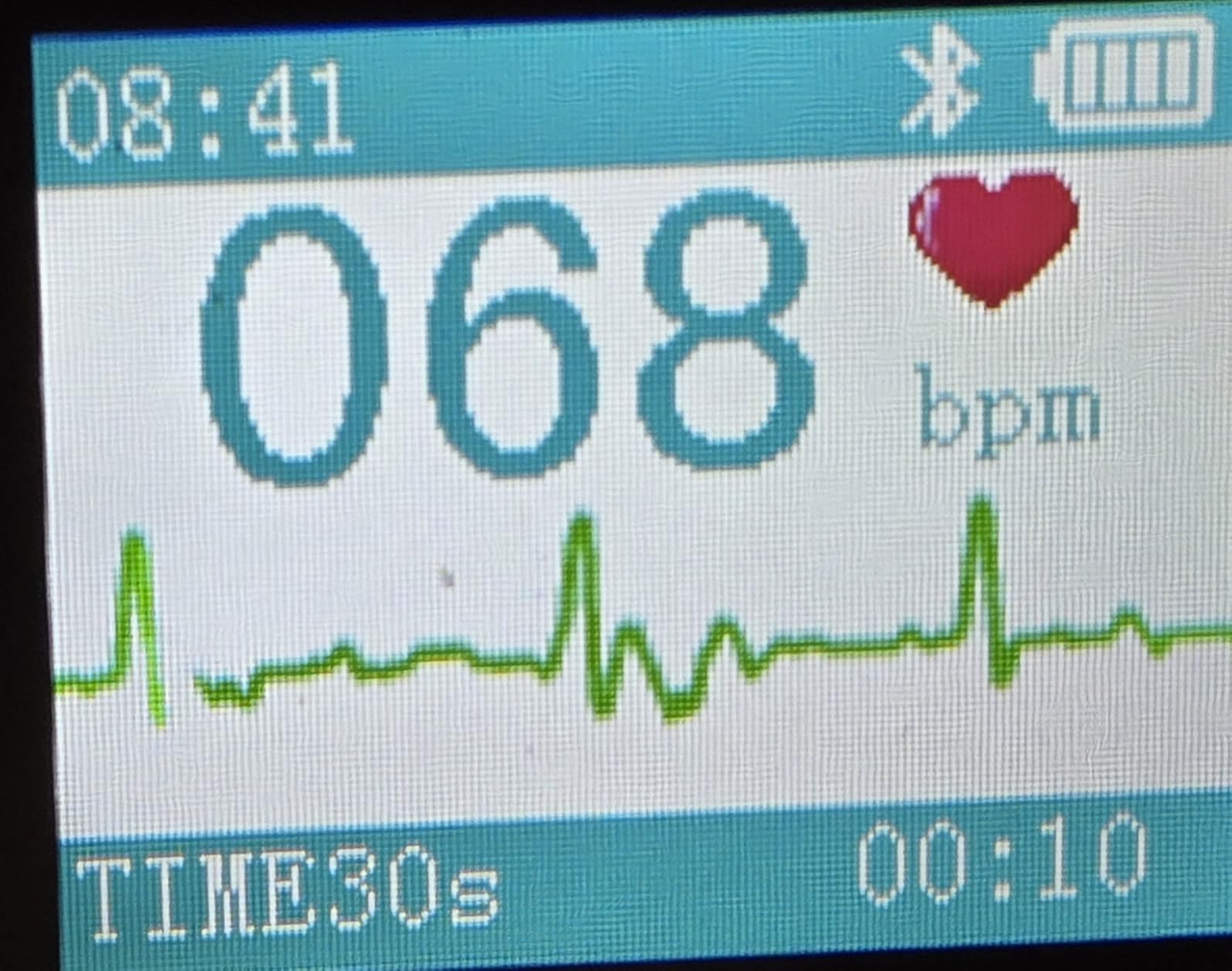 EMAY Portable ECG Monitor | Record ECG and Heart Rate | Compatible with Smartphone and PC customer photo 2