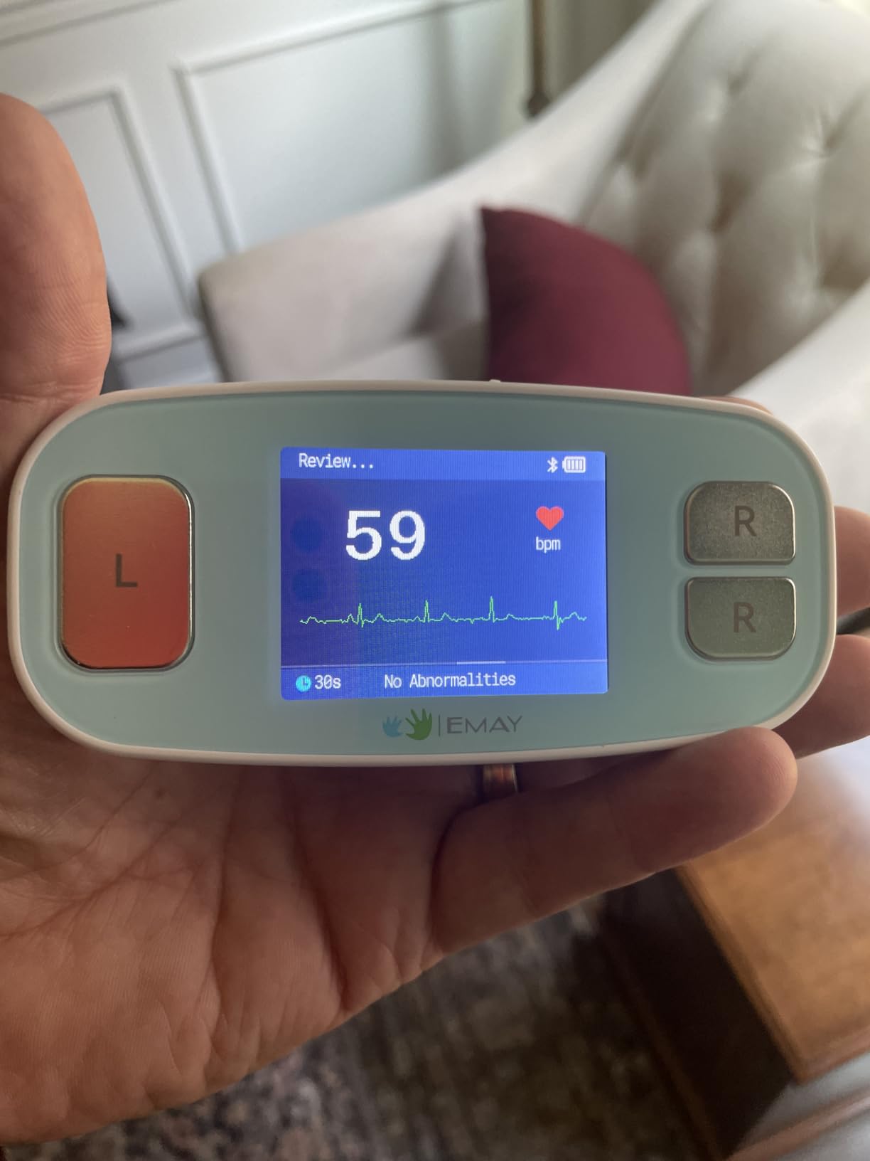 EMAY 6L Portable ECG Monitor | Record ECG and Heart Rate in 6 Channels | Compatible with Smartphone and PC | No Subscription Required customer photo 1