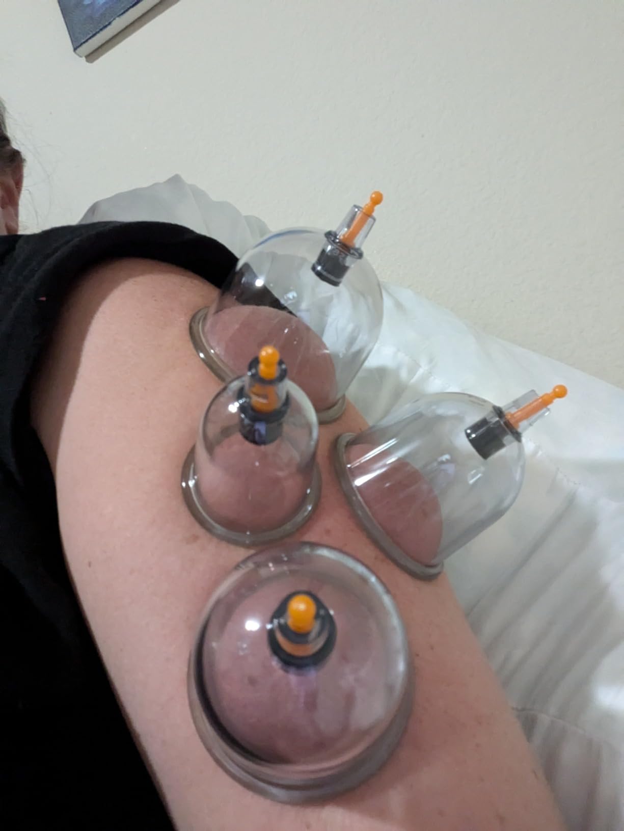 Cupluw Cupping Kit for Massage Therapy - 32 Cups Professional Chinese Cupping Set with Magnetics, Vacuum Cupping Therapy Set for Cellulite Reduction Muscle Pain Relief with Manual Pump customer photo 1
