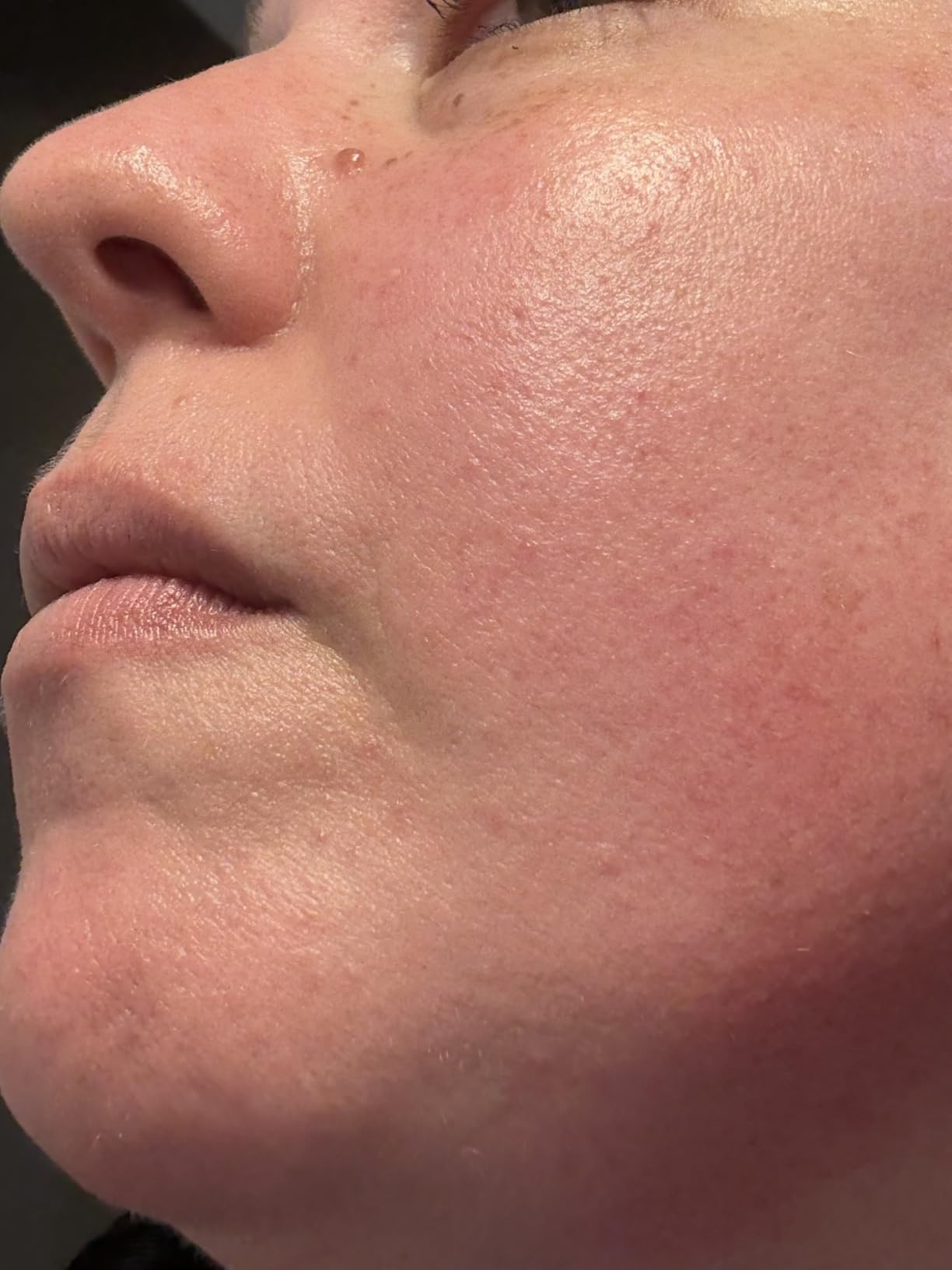 Michael Todd Beauty Sonicsmooth Pro+ Dermaplaning System & Eyebrow Trimmer customer photo 1
