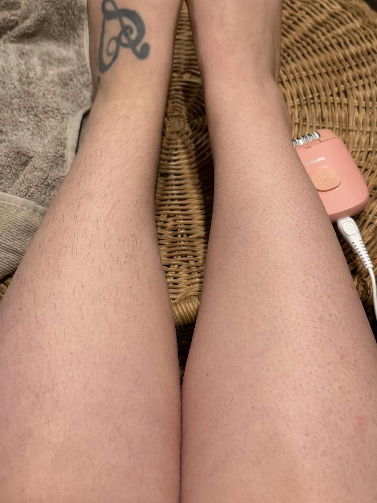 Philips Epilator Series 2000, Corded Epilator for Legs and Body, Hair Removal Device for Women, Model BRE227/00 customer photo 1