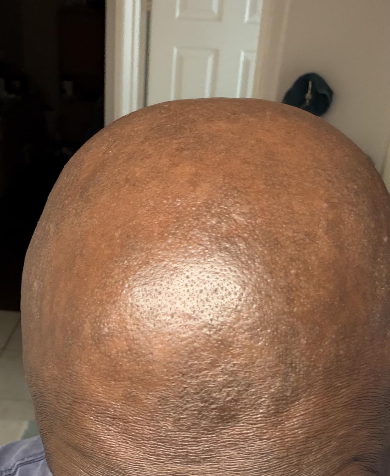 Philips Norelco Head Shaver Pro 9000 Electric Shaver, Clean & Gentle Shave customer photo 1