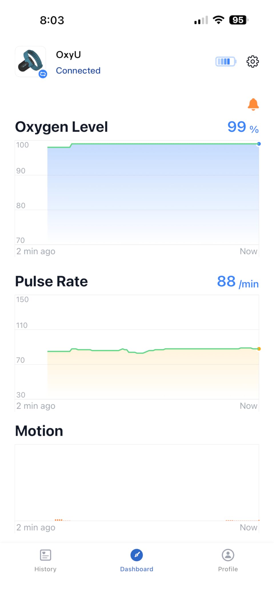 Vibeat Wrist Blood Oxygen Monitor OxyU - Continuous O2 & Heart Rate Tracking with Finger Sensor, Bluetooth Pulse Oximeter with Real-Time Notification customer photo 1